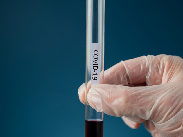 Новый штамм коронавируса Stratus подтвердили в семи областях Украины и Киеве